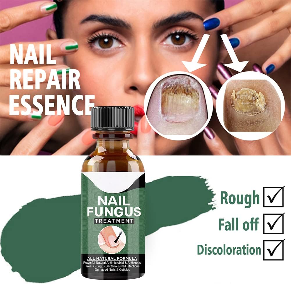 Fast Nail Fungus Remover